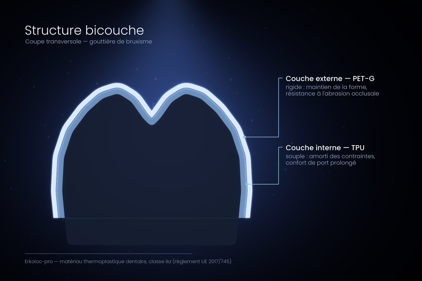 Structure bicouche de la gouttière de bruxisme : couche externe PET-G rigide, couche interne TPU souple
